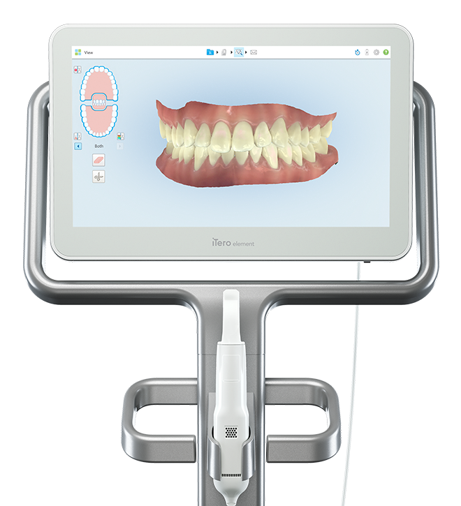 iTero digital impression system