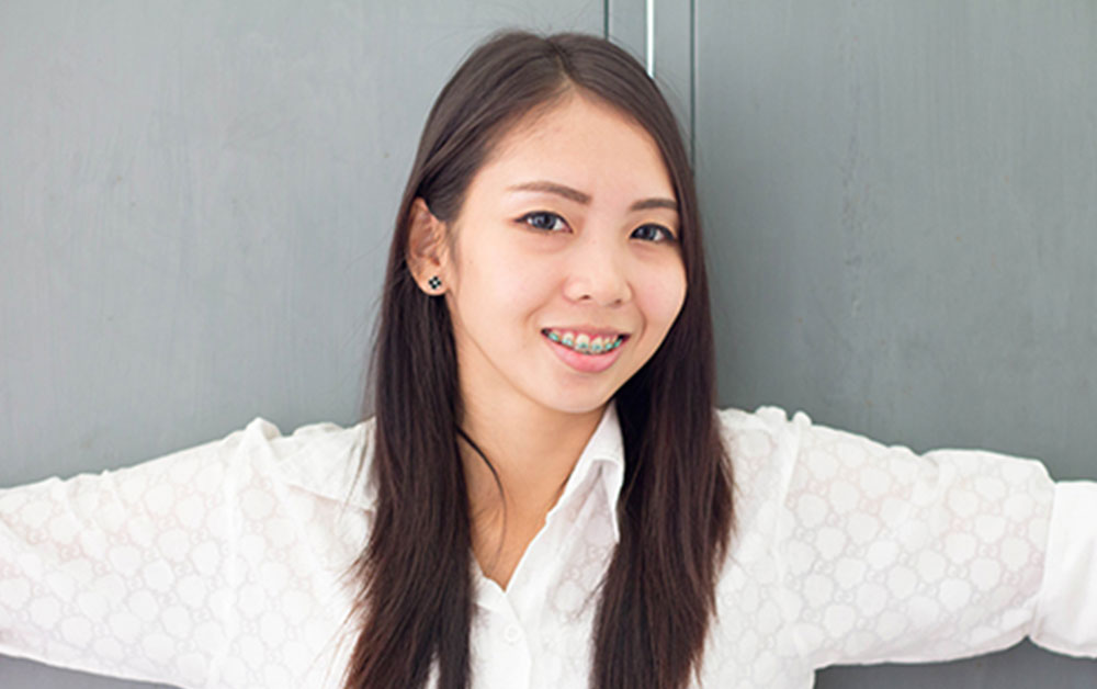 girl smiling with braces