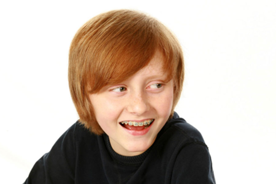young boy smiling with braces