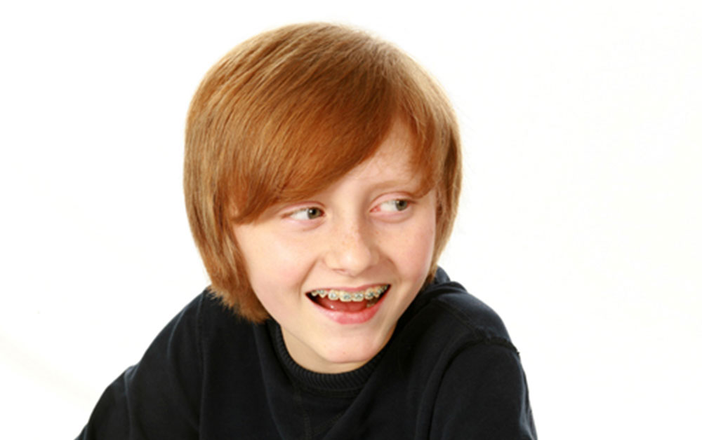 young boy smiling with braces