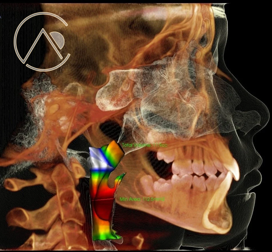 3d airway