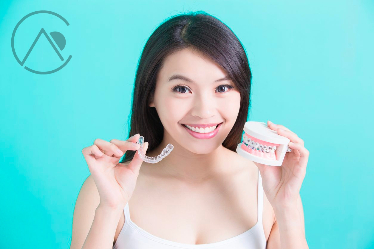Straighten Your Smile: 5 Crucial Things to Know Before Starting Invisalign Treatment